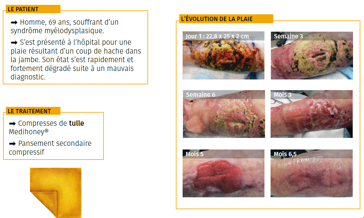 2 étude de cas plaie gangrénée