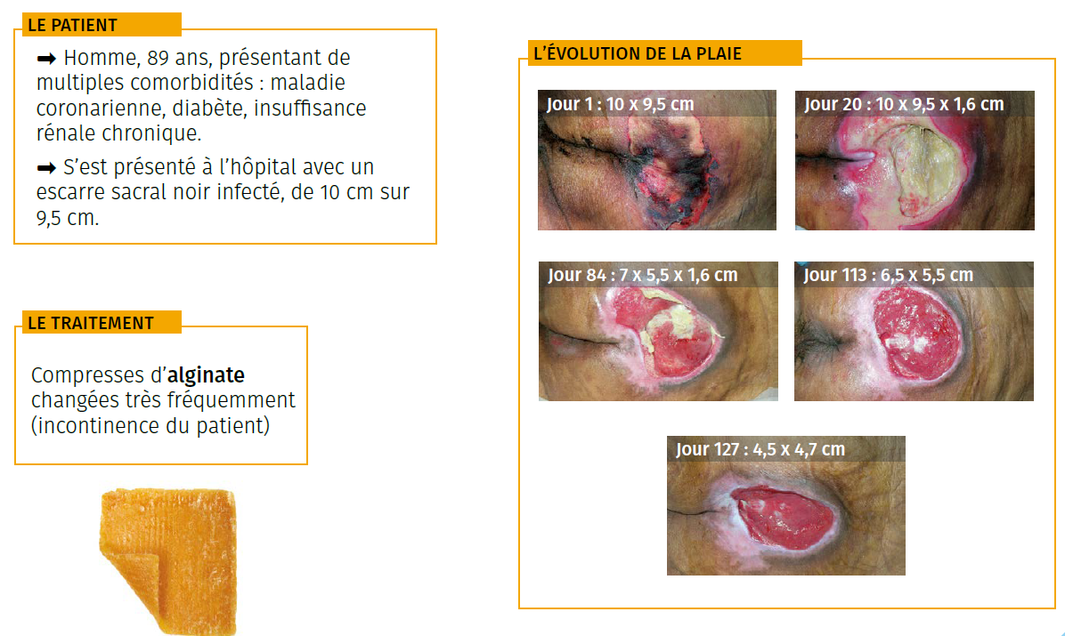 3 étude de cas escarre sacral nécrosé infecté