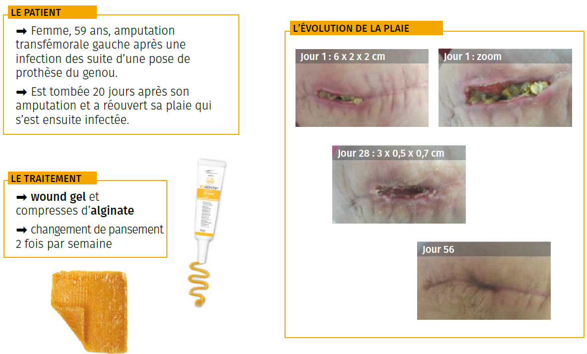 4 étude de cas plaie chirurgicale infectée