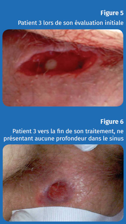 Figure 5 et 6 patient 3