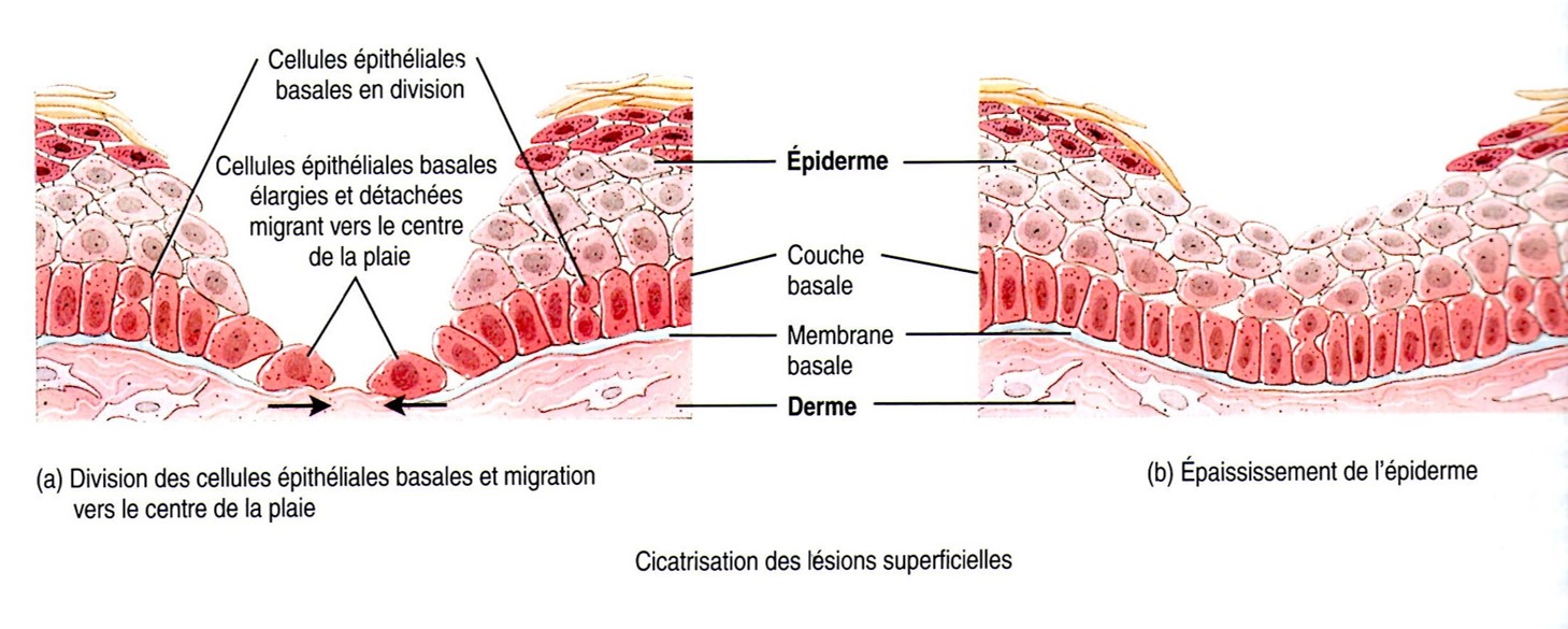 cicatrisation lésion superficielle