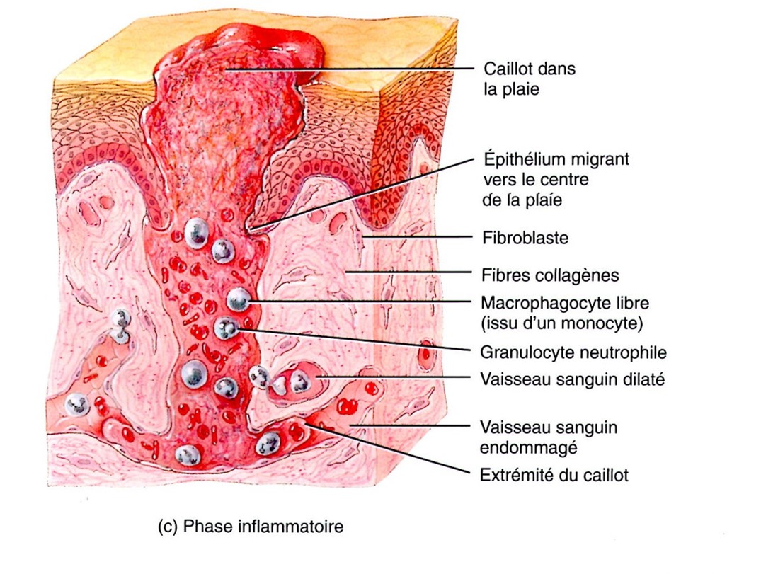 phase inflammatoire